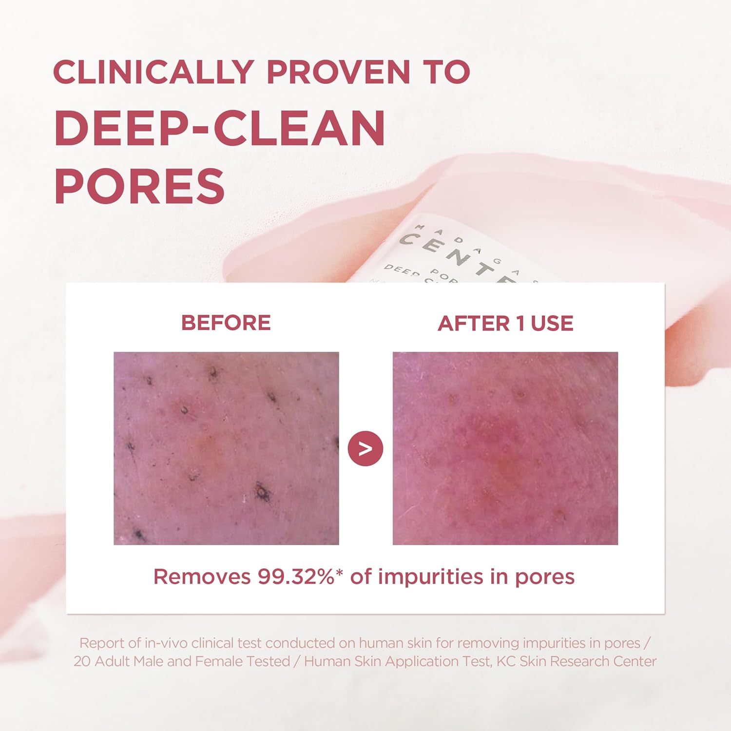 Madagascar Centella Poremizing Deep Cleansing Foam